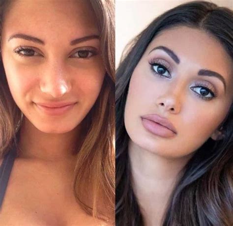 The couple reportedly briefly split after leaving the show. . Francesca farago nose job